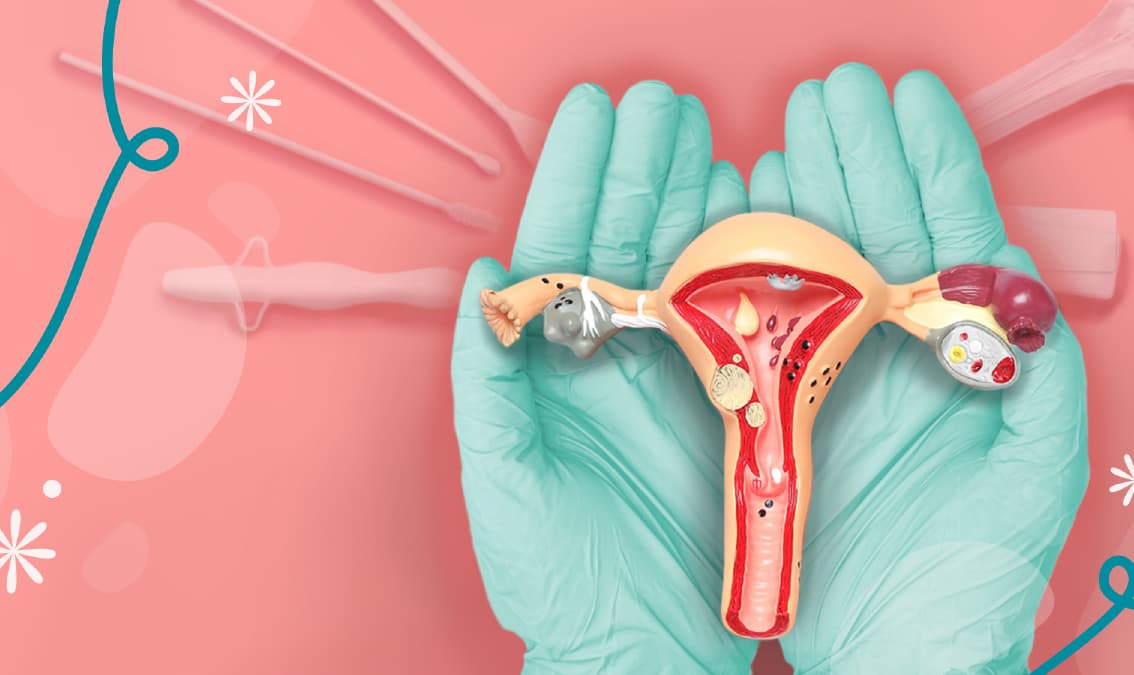 CerviCare: Actualización integral sobre Citología Cervicouterina