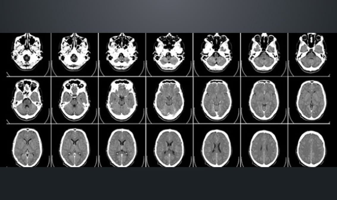 Learning and memory in the brain: a guide for teachers