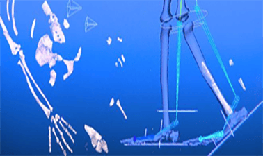 Bipedalism: The Science of Upright Walking