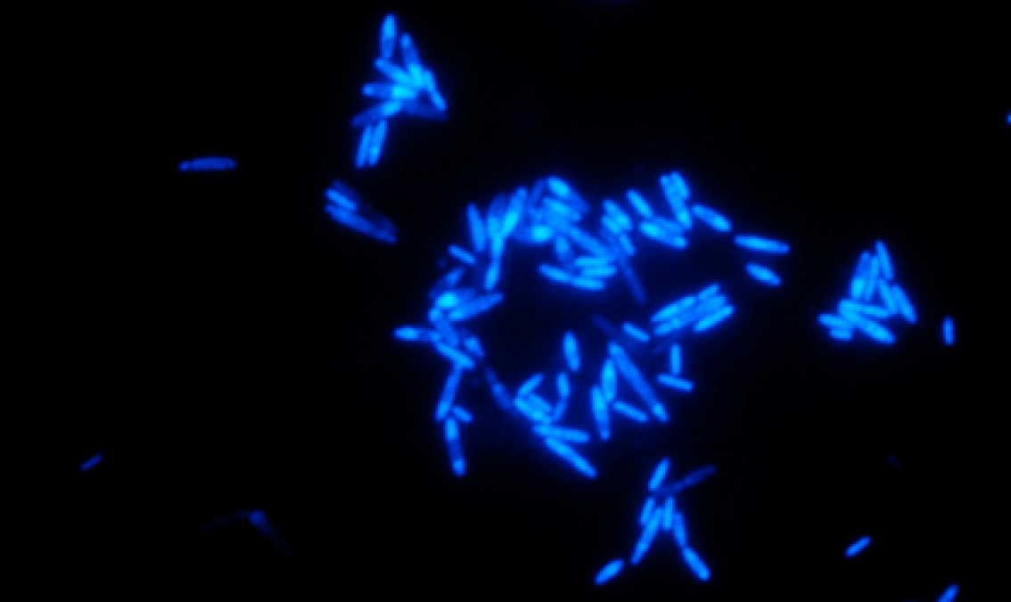 Modern Biotechnologies for Wastewater Treatment