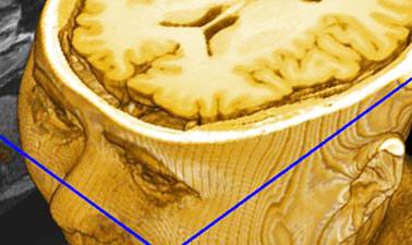 Introduction to Biomedical Imaging